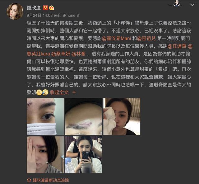 阿娇做客直播间，在线状态完全看不出受过伤？