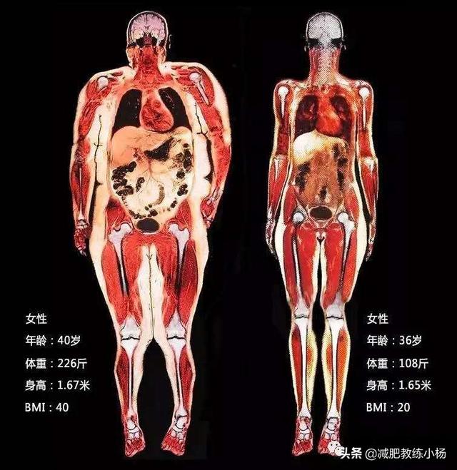 肚子上的贅肉怎麼減 光靠腹部運動可沒用 飲食和運動都要講究 每日要聞