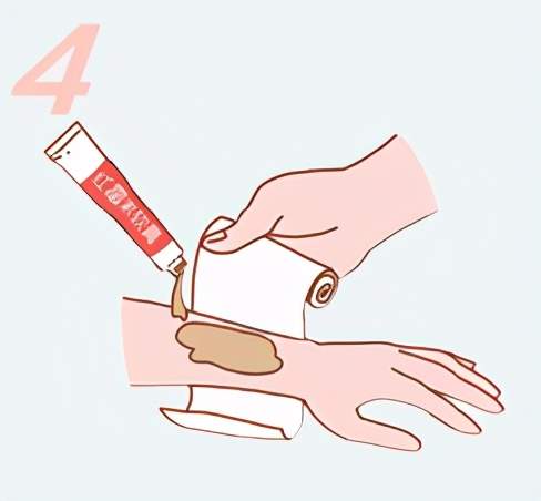 冬季冻伤了该如何急救