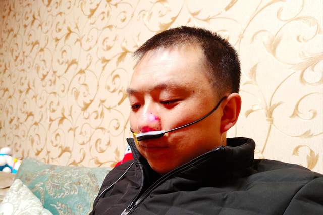 鼻炎反复出现太难受？激光治疗可缓解