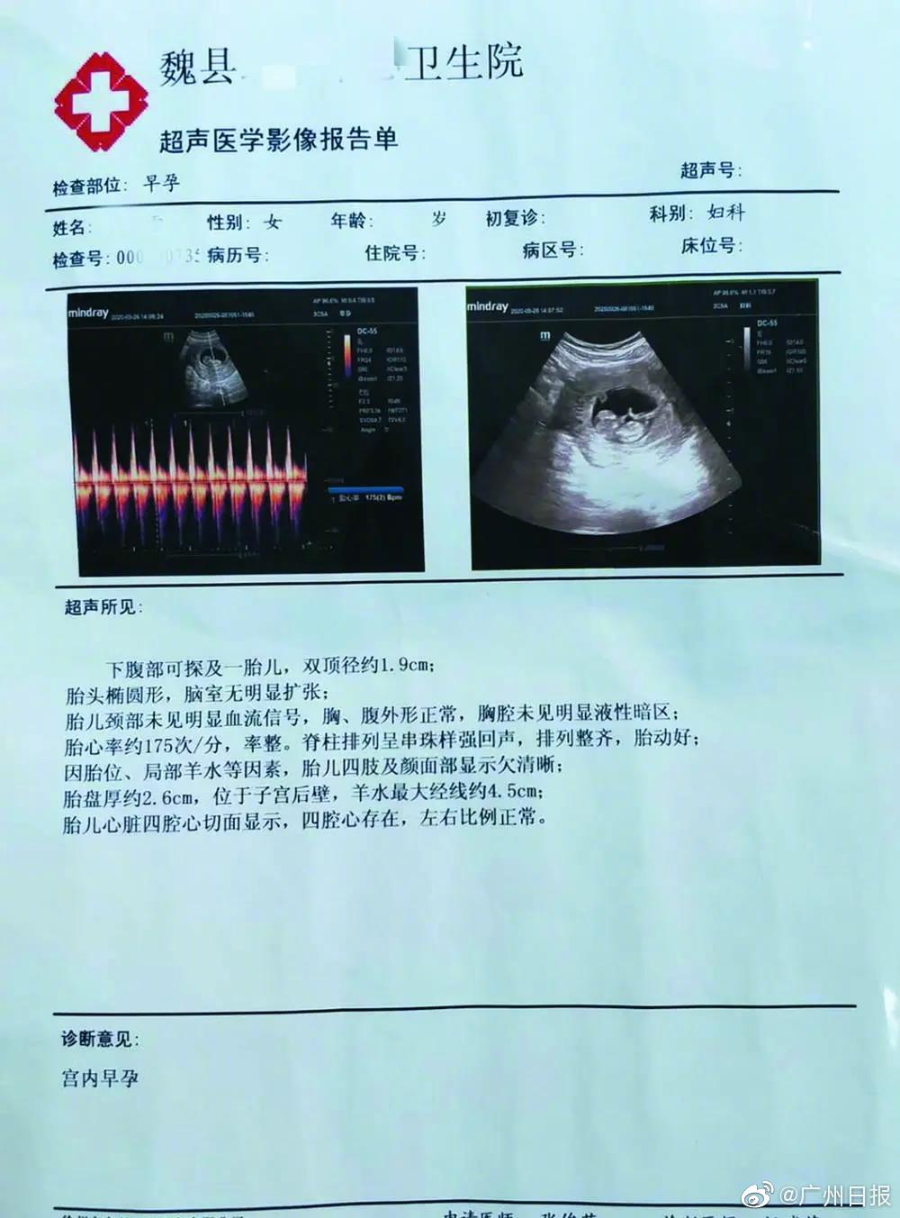 医院怀孕检查报告单图片