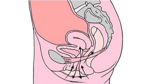 凯格尔运动会阴收缩的凯格尔运动