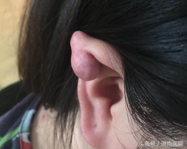 发布于:2020年07月21日浏览量:559所属栏目:耳朵长沙一名年轻女子