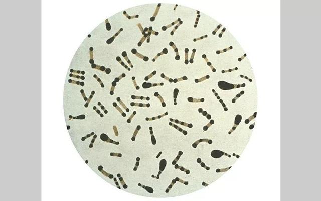 白喉杆菌显微镜镜下图图片
