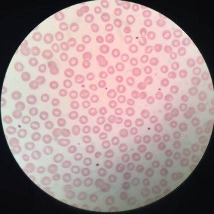 红细胞切片图图片