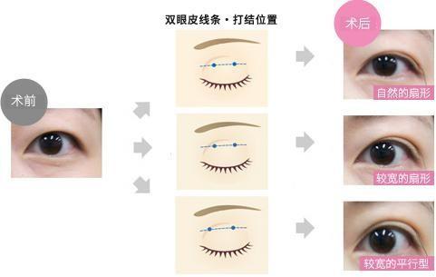 488c2186dd1543b5904f6cfa865eb73c
