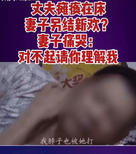 四川成都连体夫妻分手这世界还有真爱吗