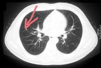 关于癌症，这三点你一定要知道！
