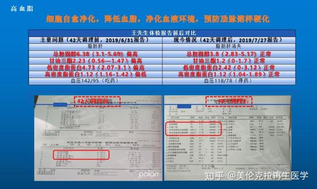 美伦克拉再生医学 | 健康管理是什么？
