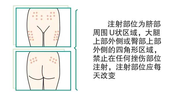 法安明皮下注射使用指导