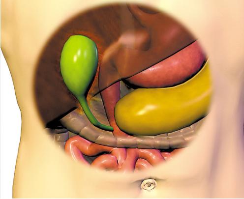 胆囊切除明明坏处这么多为什么医生还建议你切掉快看看