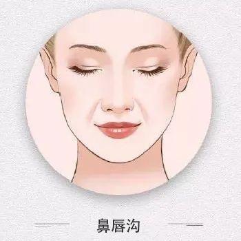 鼻唇沟问题单纯填充就能改善吗?