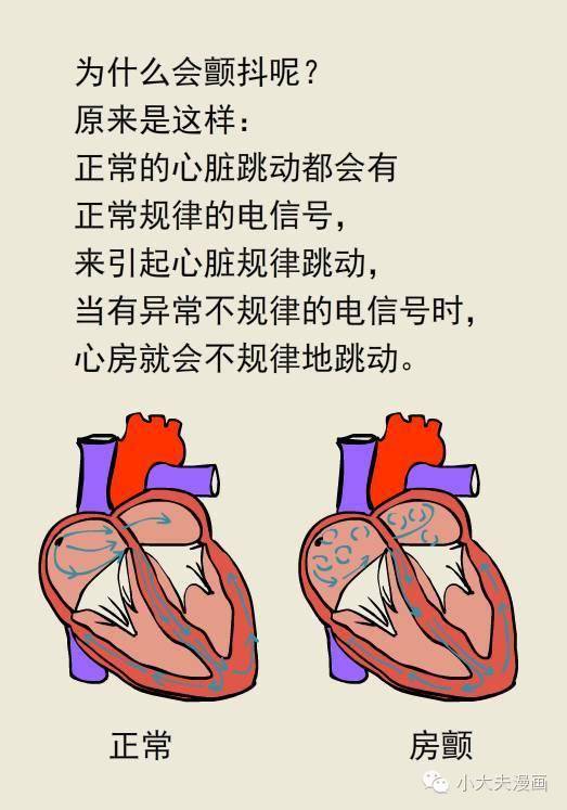 避免房颤危害,早发现才是重中之重_健康症状网