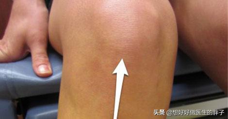 打篮球会对膝盖造成损伤吗医生和您聊聊常见运动损伤治疗与预防