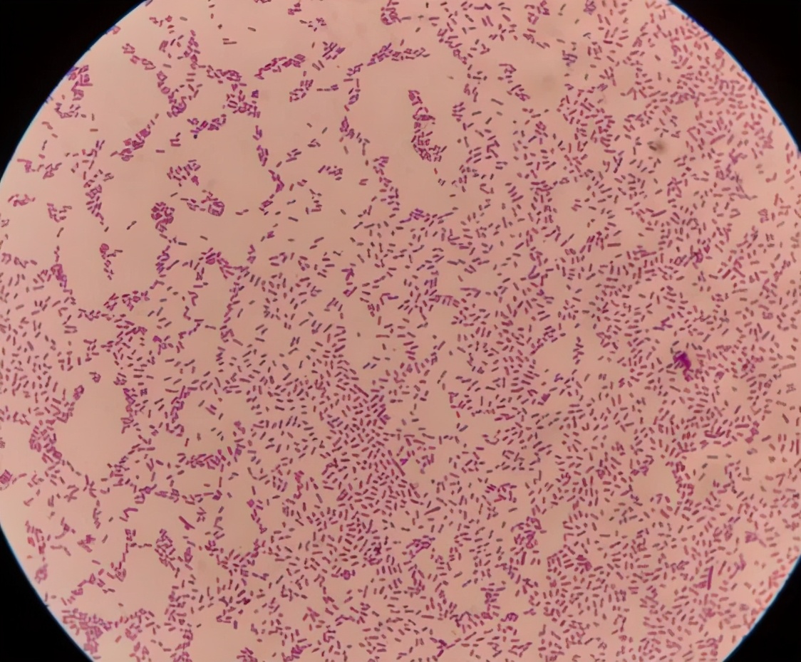 革兰阴性菌细胞壁图片