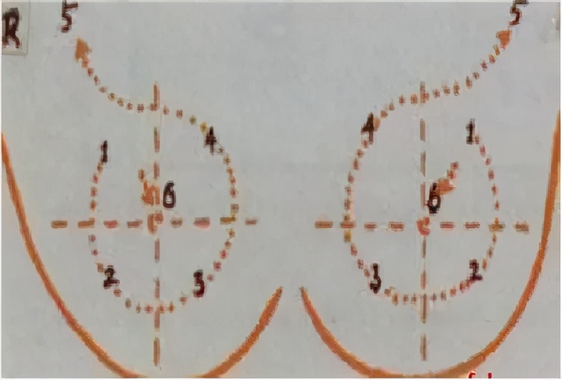 别羞羞，所有女人都该学会乳房自检