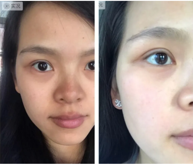 天后容祖儿同款vida glow抗糖抗氧闪释粉 全网口碑